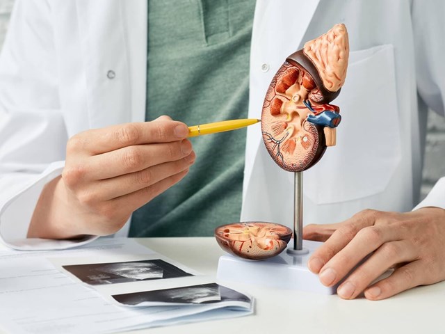 ¿Cómo el láser holmium preserva la función sexual tras la cirugía de próstata?