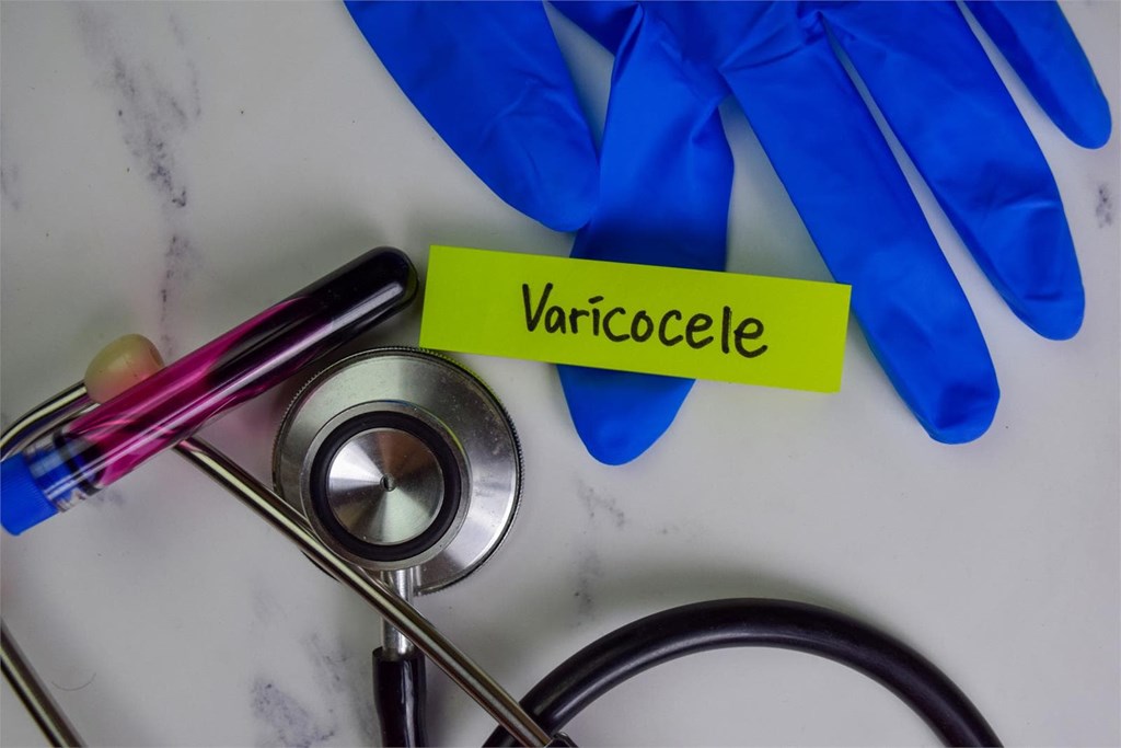 ¿Qué es el varicocele y cómo puede afectar a su fertilidad?