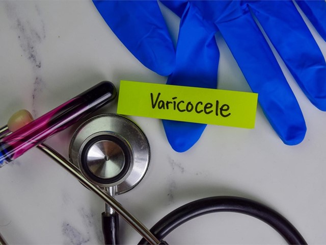 ¿Qué es el varicocele y cómo puede afectar a su fertilidad?